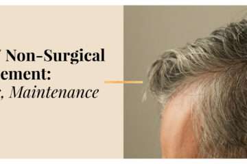 Hair Patch in Bangalore: Cost, Process & Results 2026